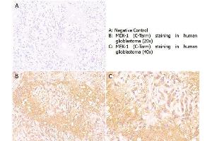 Immunohistochemistry (IHC) image for anti-Mitogen-Activated Protein Kinase Kinase 1 (MAP2K1) (C-Term) antibody (ABIN5706743)