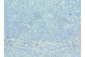 Immunohistochemistry of paraffin-embedded human tonsil tissue using ABIN7143075 at dilution of 1:100 (ACTR2 抗体  (AA 1-160))