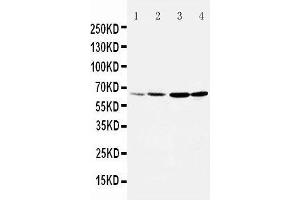 Anti-Dopamine Receptor D1 antibody, Western blotting Lane 1: Rat Testis Tissue Lysate Lane 2: Rat Brain Tissue Lysate Lane 3: U87 Cell Lysate Lane 4: HELA Cell Lysate (Dopamine Receptor d1 抗体  (Middle Region))