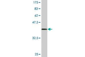 Western Blot detection against Immunogen (36. (MGAT3 抗体  (AA 430-531))