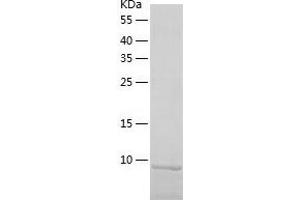 Catenin, beta Interacting Protein 1 (CTNNBIP1) (AA 1-81) protein (His-IF2DI Tag)