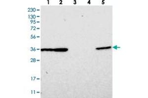Western blot analysis of Lane 1: RT-4, Lane 2: U-251 MG, Lane 3: Human Plasma, Lane 4: Liver, Lane 5: Tonsil with DNAJB14 polyclonal antibody  at 1:250-1:500 dilution. (DNAJB14 抗体)