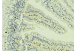 ABIN6279736 at 1/100 staining Mouse colon tissue by IHC-P. (RAB32 抗体  (C-Term))