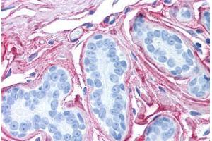 Human Breast (formalin-fixed, paraffin-embedded) stained with Collagen VI antibody ABIN364508 at 2. (COL6 抗体)