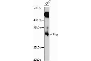 Western blot analysis of extracts of HeLa cells, using Slug antibody (ABIN3021317, ABIN3021318, ABIN3021319 and ABIN6214866) at 1:1000 dilution. (SLUG 抗体  (AA 89-268))