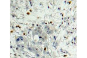 Used in DAB staining on fromalin fixed paraffin-embedded Pancreas tissue (PDGFB 抗体  (AA 21-241))