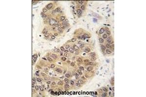 Immunohistochemistry (Paraffin-embedded Sections) (IHC (p)) image for anti-Small Ubiquitin Related Modifier 4 (SUMO4) (AA 34-63) antibody (ABIN388078)