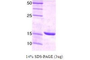 Figure annotation denotes ug of protein loaded and % gel used. (UBE2I 蛋白)