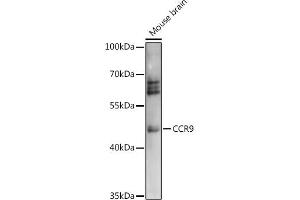 Western blot analysis of extracts of Mouse brain, using CCR9 antibody (ABIN7266312) at 1:1000 dilution. (CCR9 抗体  (AA 1-100))
