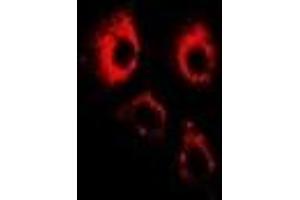 Immunofluorescent analysis of ADAM9 staining in U2OS cells. (ADAM9 抗体)