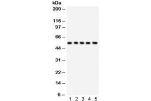 Western blot testing of 1) rat liver, 2) rat testis, 3) human HeLa, 4) RH35, and 5) HEPA lysate with SSH3BP1 antibody. (ABI1 抗体)