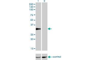 Western blot analysis of CRX over-expressed 293 cell line, cotransfected with CRX Validated Chimera RNAi (Lane 2) or non-transfected control (Lane 1). (CRX 抗体  (AA 1-300))