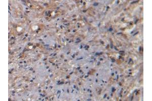 DAB staining on IHC-P; Samples: Human Prostate Tissue) (NKA 抗体)