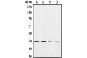 Western blot analysis of CK2 beta expression in HeLa (A), Jurkat (B), mouse brain (C), rat brain (D) whole cell lysates. (CSNK2B 抗体  (C-Term))