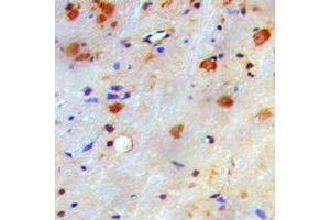 Immunohistochemical analysis of nm23-H1 staining in human brain formalin fixed paraffin embedded tissue section. (NME1 抗体  (Center))