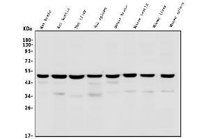 Western blot analysis of TSG101 using anti-TSG101 antibody (ABIN7600712).
