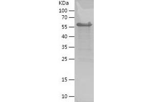 Western Blotting (WB) image for Melanoma Antigen Family D, 4 (MAGED4) (AA 1-350) protein (His-IF2DI Tag) (ABIN7123902) (Melanoma Antigen Family D, 4 (MAGED4) (AA 1-350) protein (His-IF2DI Tag))