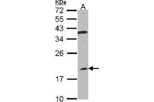 WB Image Sample(30 ug whole cell lysate) A:Raji , 12% SDS PAGE antibody diluted at 1:1000 (IFNA8 抗体)