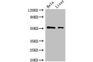 Western Blot Positive WB detected in: Hela whole cell lysate, Rat liver tissue All lanes: SLC10A3 antibody at 2 μg/mL Secondary Goat polyclonal to rabbit IgG at 1/50000 dilution Predicted band size: 51, 48 kDa Observed band size: 51 kDa (SLC1A3 抗体  (AA 7-151))