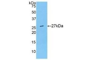 Detection of Recombinant ANGPTL6, Mouse using Polyclonal Antibody to Angiopoietin Like Protein 6 (ANGPTL6) (ANGPTL6 抗体  (AA 238-457))