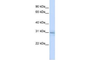 WB Suggested Anti-METTL5 Antibody Titration: 0. (METTL5 抗体  (N-Term))