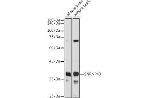 Western blot analysis of extracts of various cell lines, using SNRNP40 antibody (ABIN7270361) at 1:1000 dilution. (SNRNP40 抗体)