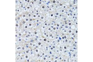 Immunohistochemistry of paraffin-embedded mouse liver using HIST2H2BE antibody. (HIST2H2BE 抗体)