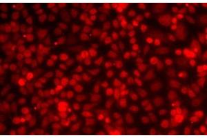 Immunofluorescence analysis of MCF7 cells using ILF2 Polyclonal Antibody (ILF2 抗体)