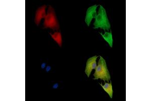 ABIN7095962 and ABIN7100024 staining  cells by IF/ICC.