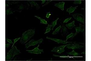 Immunofluorescence of monoclonal antibody to BRAF on HeLa cell. (BRAF 抗体  (AA 138-231))