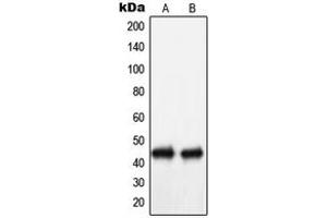Western blot analysis of NIP1 expression in Ramos (A), COLO205 (B) whole cell lysates.