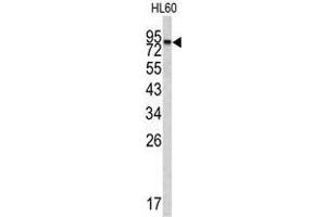 Image no. 1 for anti-Carboxypeptidase X (M14 Family), Member 2 (CPXM2) (N-Term) antibody (ABIN452869) (CPXM2 抗体  (N-Term))