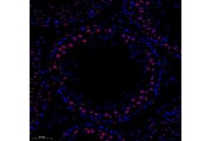 Immunofluorescence (Paraffin-embedded Sections) (IF (p)) image for anti-General Transcription Factor IIB (GTF2B) antibody (ABIN7074034)
