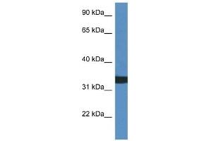 Western Blot showing ACER1 antibody used at a concentration of 1 ug/ml against HCT15 Cell Lysate (ACER1 抗体  (C-Term))