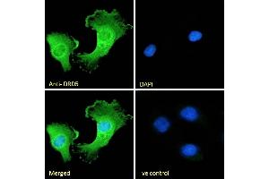 (ABIN334388) Immunofluorescence analysis of paraformaldehyde fixed U251 cells, permeabilized with 0. (DRD5 抗体  (Internal Region))