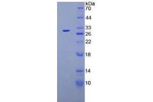 SDS-PAGE analysis of Mouse Plasminogen Protein. (PLG 蛋白)