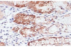 Immunohistochemistry of paraffin-embedded Human stomach using LYZ Polyclonal Antibody at dilution of 1:100 (40x lens). (LYZ 抗体)