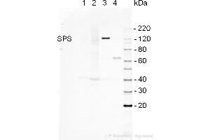 Western Blotting (WB) image for anti-Sucrose Phosphate Synthase (SPS) antibody (ABIN2559391)