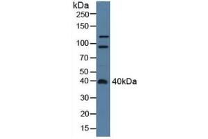 Detection of CENTa2 in Rat Serum using Polyclonal Antibody to Centaurin Alpha 2 (CENTa2)