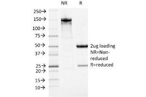 SDS-PAGE Analysis Purified ATRX Mouse Monoclonal Antibody (23c). (ATRX 抗体)