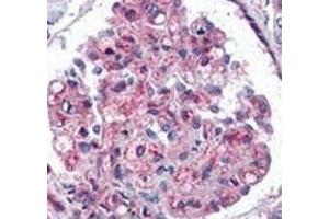 IHC analysis of FFPE human kidney tissue stained with anti-Ubiquitin antibody (Ubiquitin 抗体  (AA 1-32))