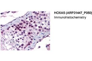 Immunohistochemistry (IHC) image for anti-Homeobox A5 (HOXA5) (Middle Region) antibody (ABIN2777305)