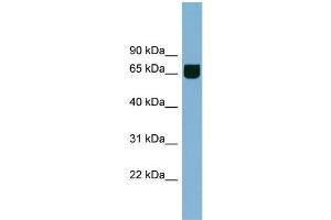 Western Blotting (WB) image for anti-Resistance To Inhibitors of Cholinesterase 8 Homolog B (RIC8B) (Middle Region) antibody (ABIN2787074)