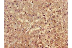 Immunohistochemistry of paraffin-embedded human liver tissue using ABIN7152690 at dilution of 1:100 (FARP1 抗体  (AA 1-300))