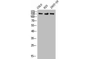 Western Blot analysis of COLO 823 293T-UV cells using Phospho-Flt-1 (Y1048) Polyclonal Antibody
