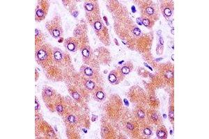 Immunohistochemistry (IHC) image for anti-Wilms Tumor 1 (WT1) antibody (ABIN7308510) (WT1 抗体)