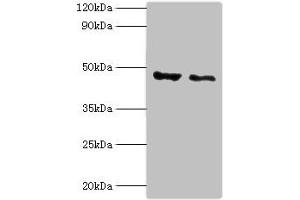 Western blot All lanes: PLIN2 antibody at 4 μg/mL Lane 1: HepG2 whole cell lysate Lane 2: Hela whole cell lysate Secondary Goat polyclonal to rabbit IgG at 1/10000 dilution Predicted band size: 48 kDa Observed band size: 48 kDa (ADRP 抗体  (AA 168-437))