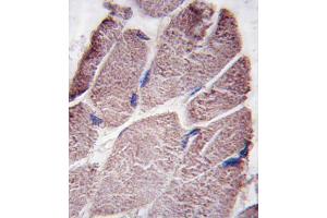Formalin-fixed and paraffin-embedded human skeletal muscle tissue reacted with PTPD1 antibody (Center), which was peroxidase-conjugated to the secondary antibody, followed by DAB staining. (PTPN21 抗体  (AA 751-780))