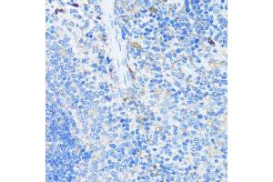 Immunohistochemistry of paraffin-embedded mouse spleen using EIF3J antibody.