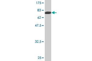 Western Blot detection against Immunogen (81. (MYOC 抗体  (AA 1-504))